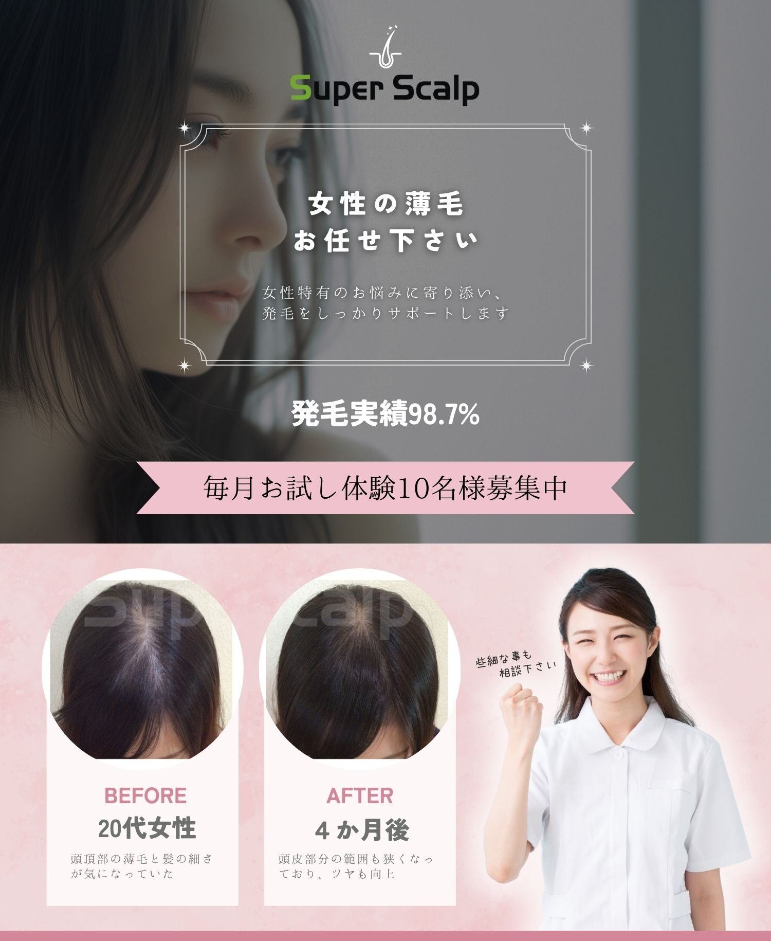 女性の薄毛(FAGA・びまん性脱毛症)の施術治療