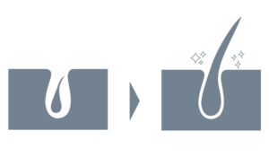 スーパースカルプ発毛センター福山店・岡山駅前店の発毛コース
