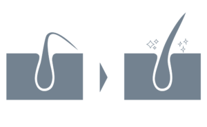 スーパースカルプ発毛センター福山店・岡山駅前店の育毛コース