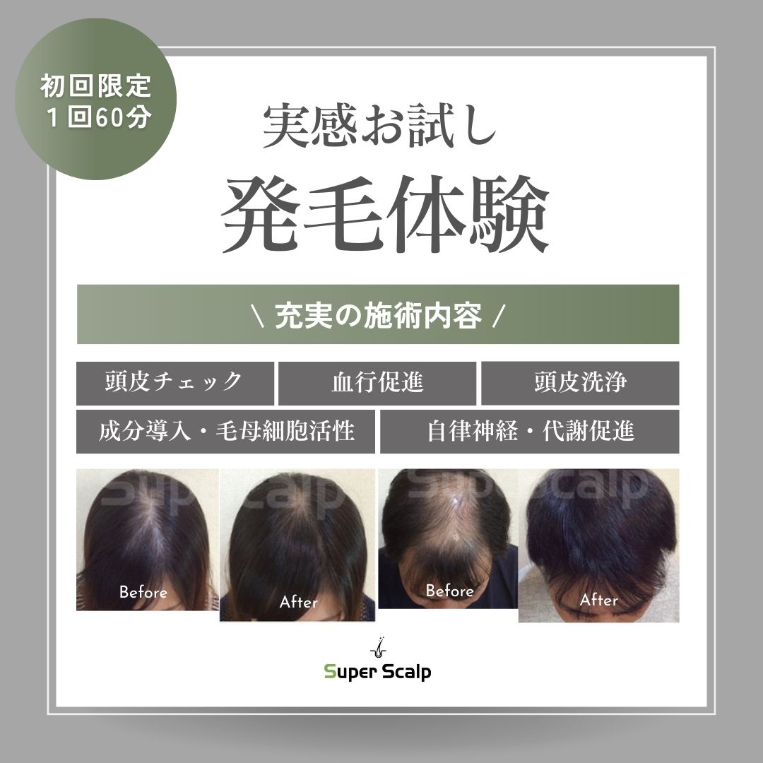 お試し発毛体験